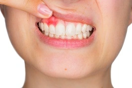 10 Effective Ways to Manage Sensitive Teeth