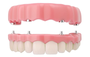 Full Mouth Restoration
