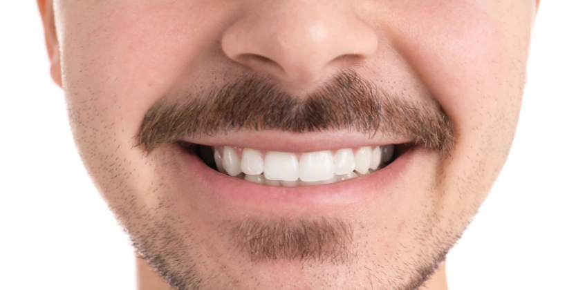 Gaps and uneven teeth After