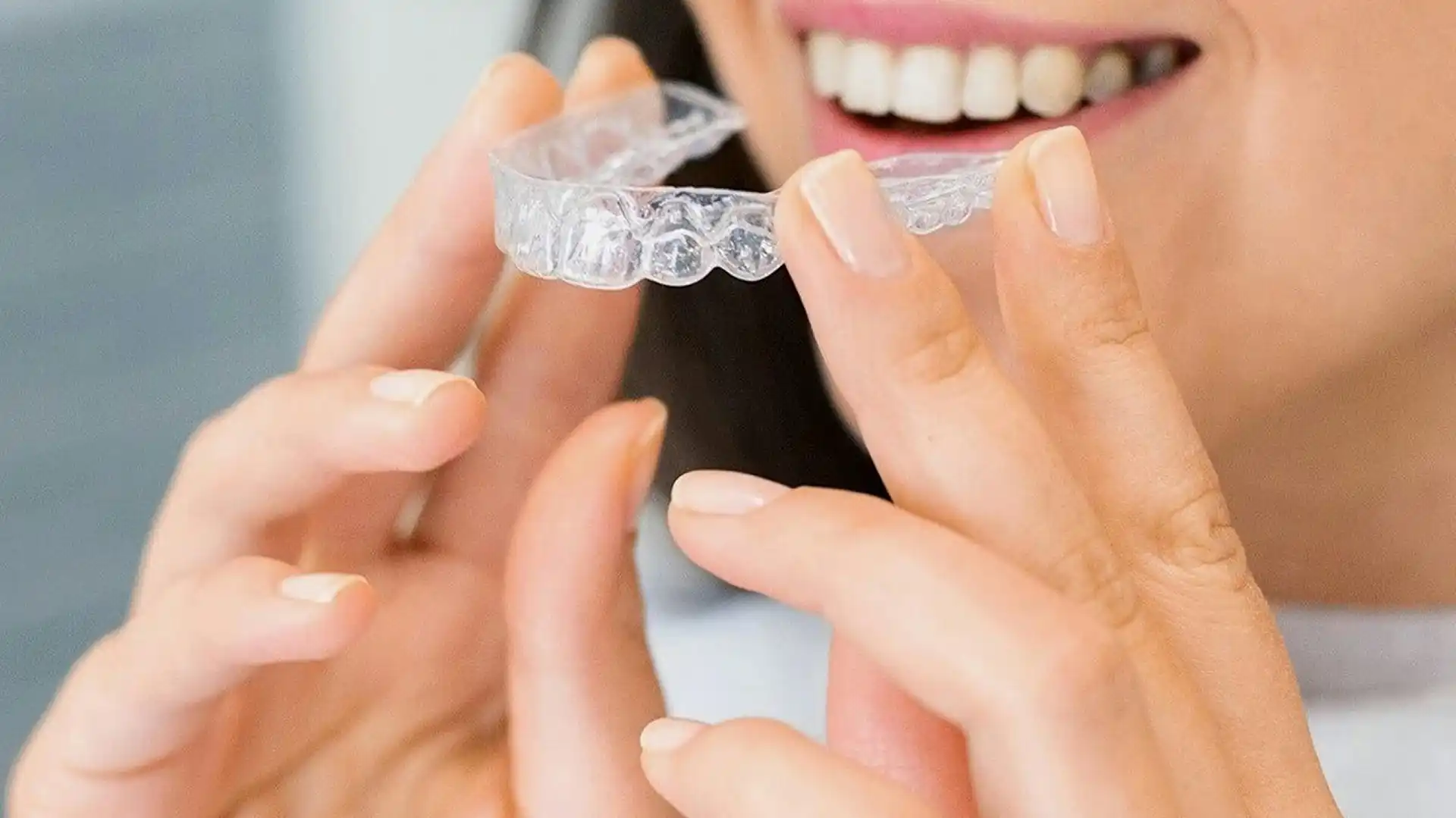 Invisalign (Clear Braces)