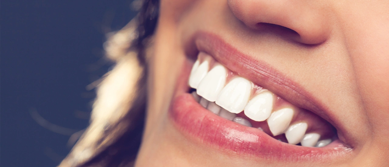 Transform Your Smile With Prophyjet Stain Removal Treatment