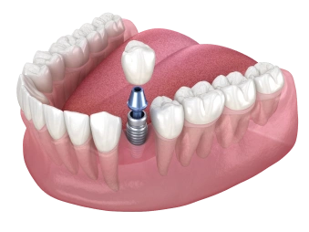 Shutterstock 1673668807 1